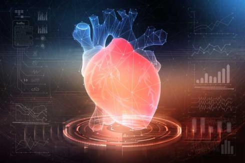 risque cardiovasculaire